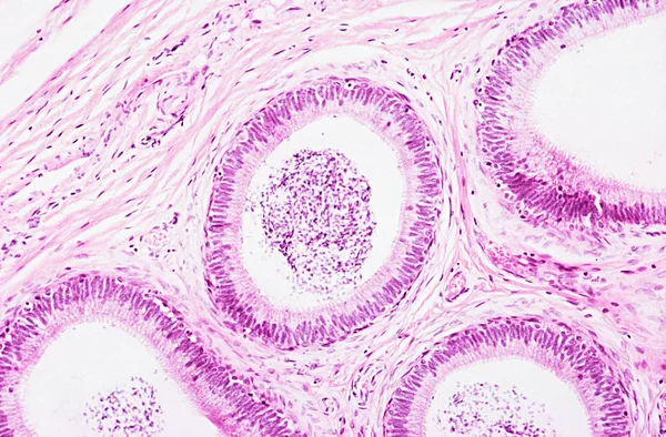 Bajo Alta Magnificación Vista Microscópica Del Epidídimo — Foto de Stock