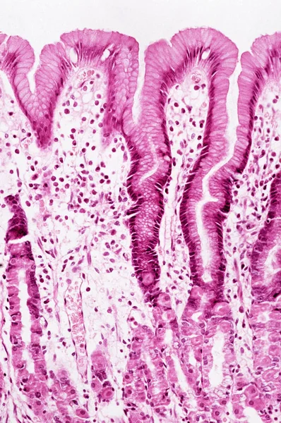 Sous Grossissement Élevé Vue Microscopique Muqueuse Gastrique — Photo