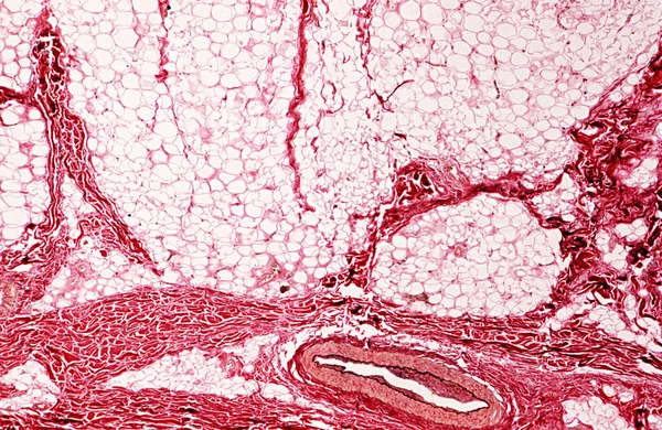 Bajo Alta Magnificación Vista Microscópica Subcutis Piel — Foto de Stock