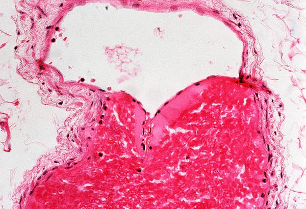 Sob Visão Microscópica Alta Ampliação Das Veias Humanas — Fotografia de Stock