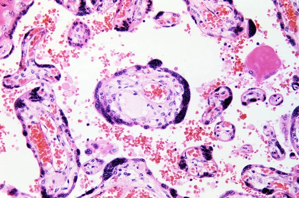 Under high magnification microscopic view of chorionic villus