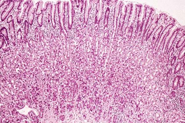 Sob Visão Microscópica Alta Ampliação Mucosa Estômago — Fotografia de Stock