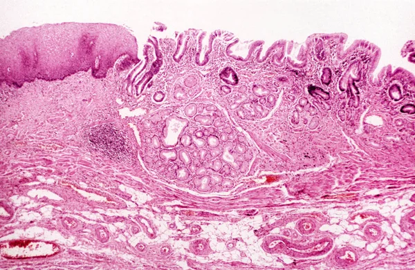 Onder Microscopische Weergave Hoge Vergroting Van Slokdarm — Stockfoto