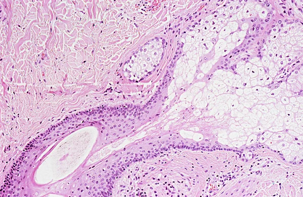 Sob Visão Microscópica Alta Ampliação Das Células Pele — Fotografia de Stock