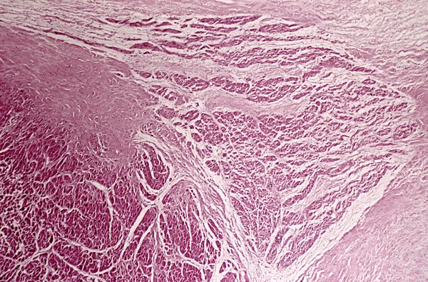 Under high magnification microscopic view of atrioventricular node