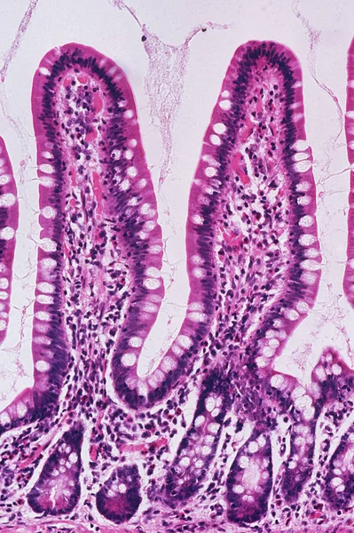 Onder Microscopische Weergave Hoge Vergroting Van Het Ileum — Stockfoto