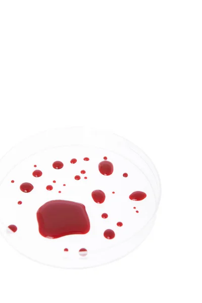 Sangue Una Capsula Petri — Foto Stock