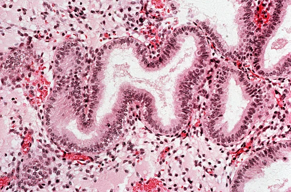 Endometrium Yüksek Büyütme Mikroskobik Görünümü Altında — Stok fotoğraf