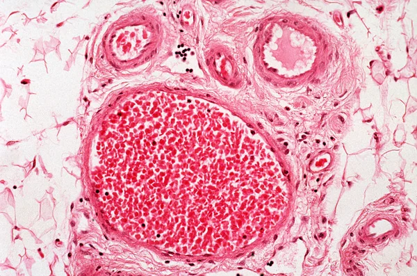 Pod Dużym Powiększeniu Obraz Mikroskopowy Naczyń Krwionośnych — Zdjęcie stockowe