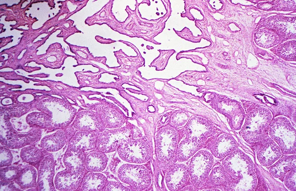 Testis Yüksek Büyütme Mikroskobik Görünümü Altında — Stok fotoğraf