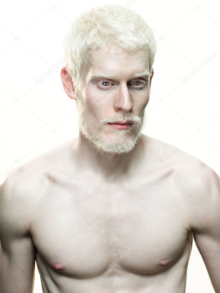 Portrait of an albino man