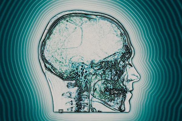 Nahaufnahme Des Menschlichen Gehirns — Stockfoto