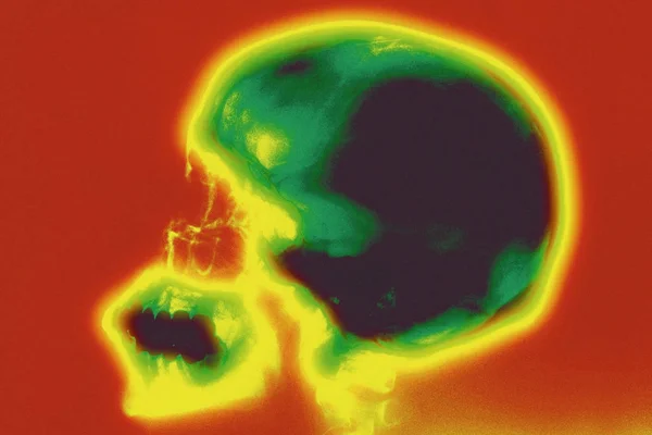 Strzał Zbliżenie Ludzkiego Mózgu Usg Kolorowe — Zdjęcie stockowe