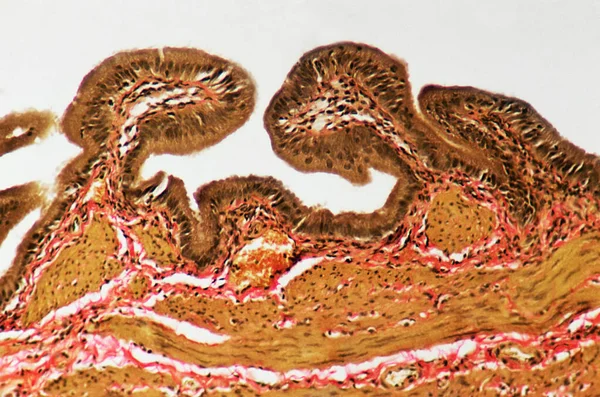 Mucosa en la vesícula biliar — Foto de Stock