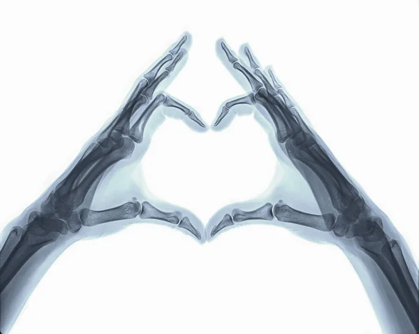 按心形排列的手和手指的X 光图像 — 图库照片
