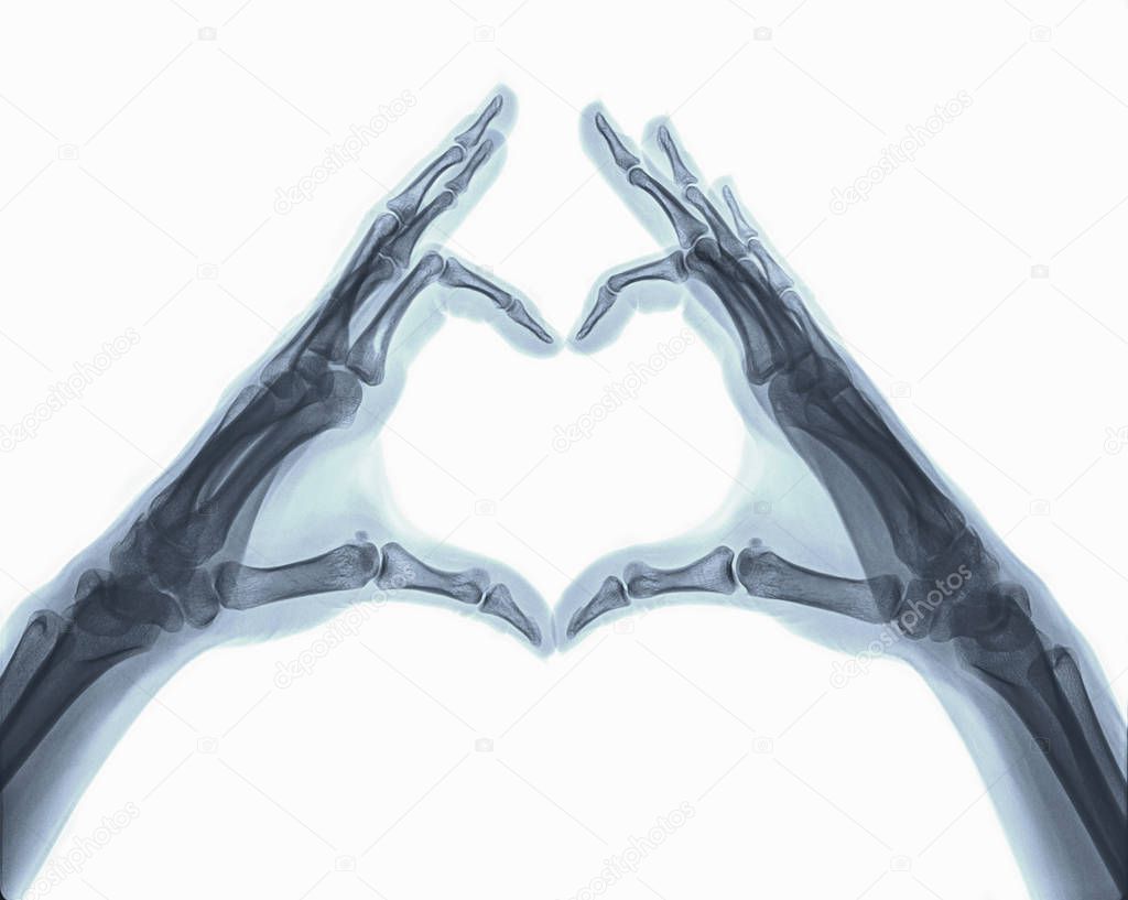 Xray image of hands and fingers in shape of heart