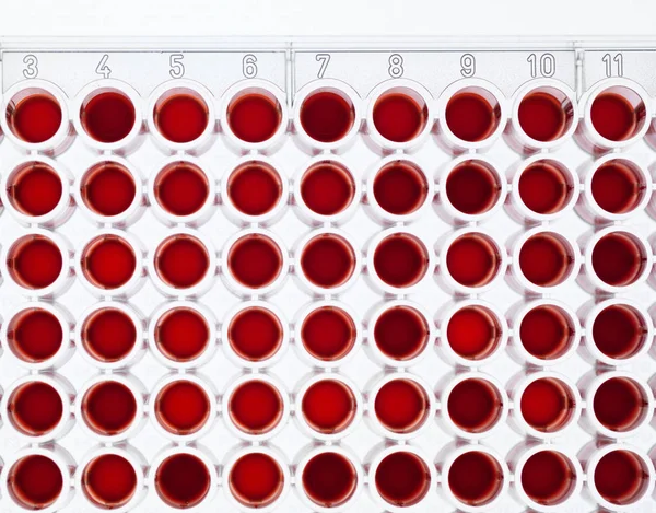 Blood Screening Top View — Stock Photo, Image