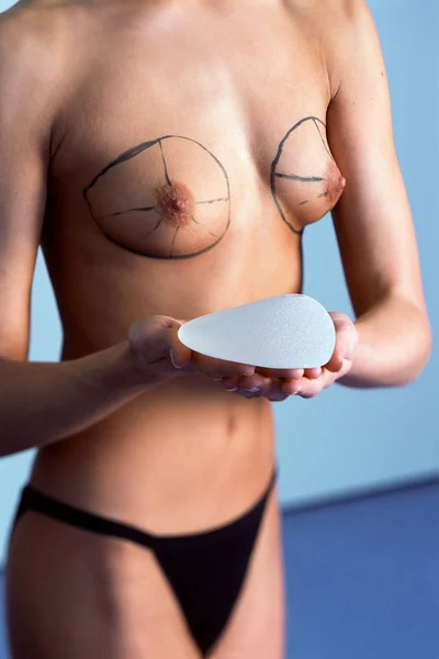 Mulher Segurando Implante Mamário Silício — Fotografia de Stock
