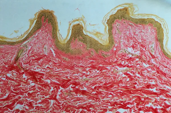Дерма Эпидермия Микроскопии — стоковое фото