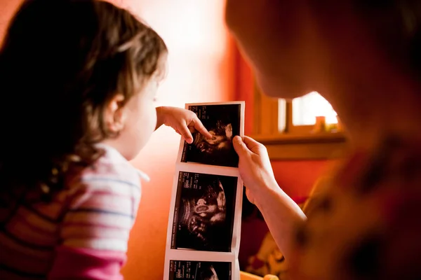 Madre Hija Que Estudian Radiografía Del Bebé — Foto de Stock