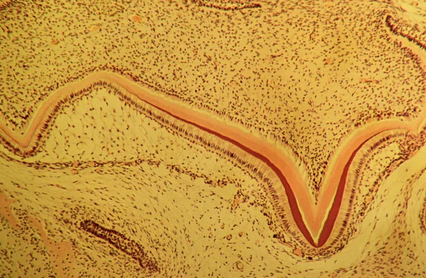 Developing Tooth View Microscope — Stock Photo, Image