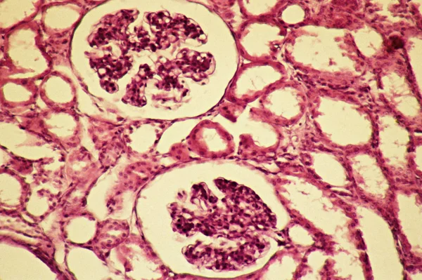 Glomeruli Widoku Nerki Mikroskopu — Zdjęcie stockowe