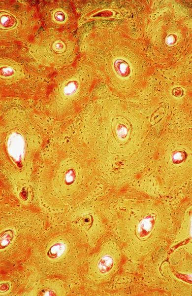 Cavidades Vista Ósea Desde Microscopio —  Fotos de Stock