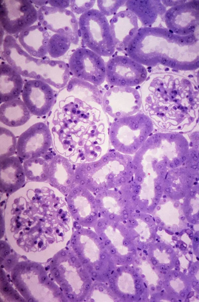 Glomeruli y tubules en riñón —  Fotos de Stock