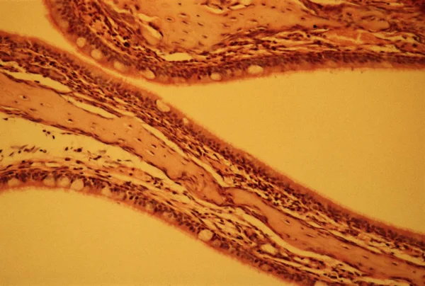 Veduta Della Cavità Nasale Dal Microscopio — Foto Stock