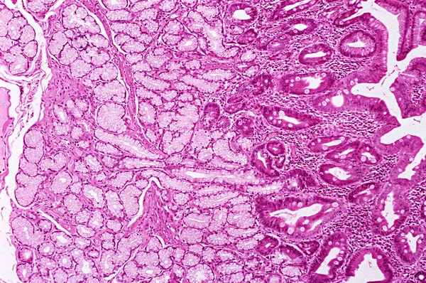 十二指肠中的不伦瑞克腺体 — 图库照片