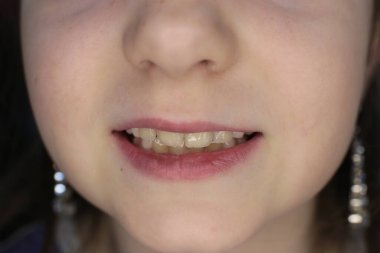 kız yüz, ağız ve gülümseme makro fotoğraf