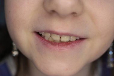 kız yüz, ağız ve gülümseme makro fotoğraf