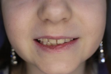 kız yüz, ağız ve gülümseme makro fotoğraf