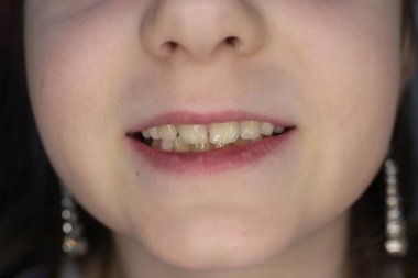 kız yüz, ağız ve gülümseme makro fotoğraf