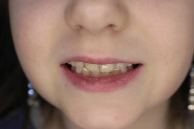 kız yüz, ağız ve gülümseme makro fotoğraf