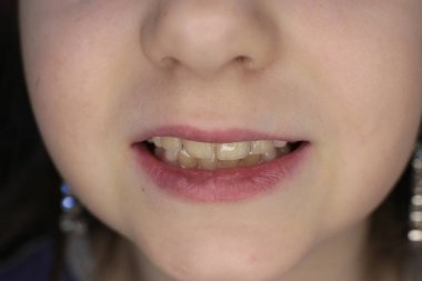 kız yüz, ağız ve gülümseme makro fotoğraf