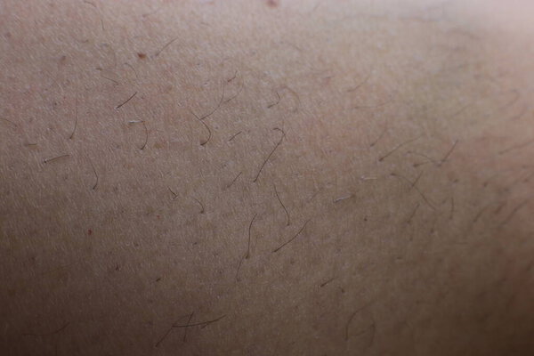 hairy body requires depilation macro view