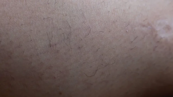 Hairy Body Requires Depilation Macro View Human Body Skin Man — Stock Photo, Image