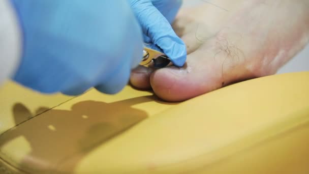 Medizinische Fußpflege für Männer — Stockvideo