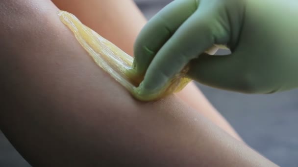 Hair removal sugaring — Stock Video