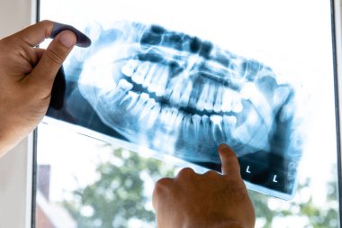 Doktor insan çenesinin x-ray resmini inceler