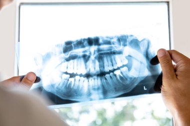 Doktor insan çenesinin x-ray resmini inceler