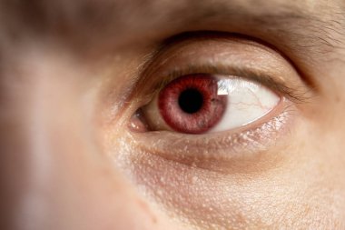 Kırmızı gözlü parlak erkek gözü, yaklaş.