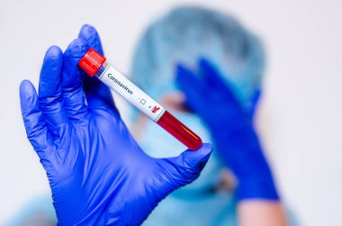 Tıbbi laboratuvar asistanı pozitif Coronavirus kan örneğiyle test tüpü tutuyor..