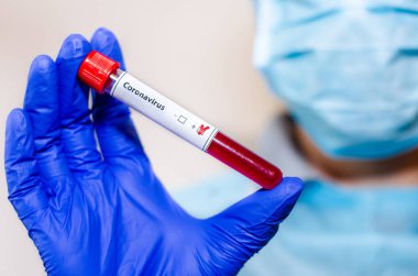 Medical laboratory assistant holding test tube with positive Cor