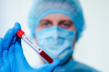 Tıbbi laboratuvar asistanı pozitif Coronavirus kan örneğiyle test tüpü tutuyor..
