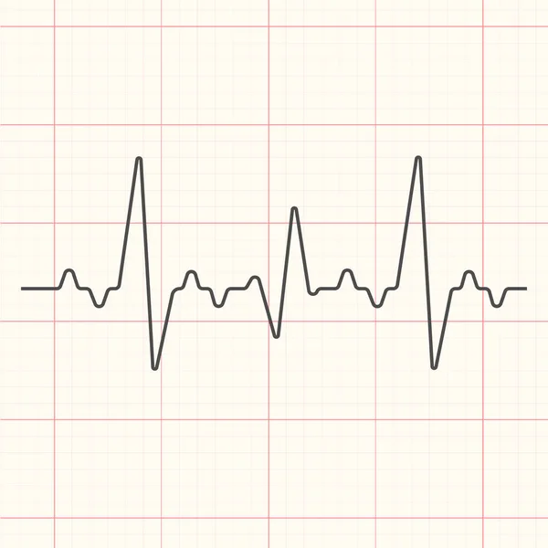 Illustrazione linea cardiogramma nero — Vettoriale Stock