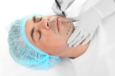 Plastik cerrahi kavramı. Ellerinde eldiven erkek yüz işaretleme