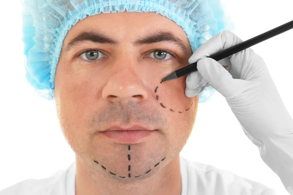 Plastic surgery concept. Hand in glove marking male face — Stock Photo, Image