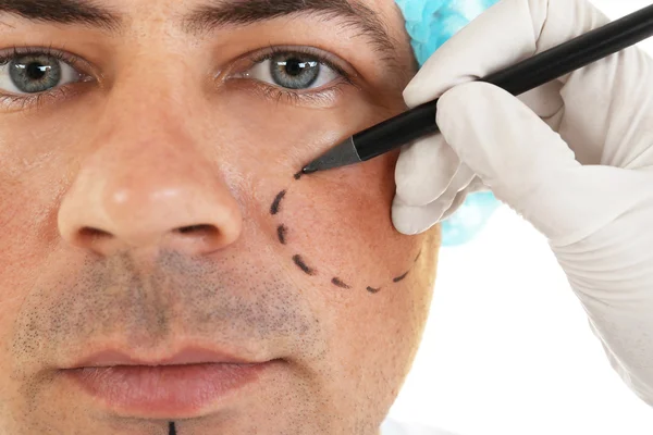 Plastische Chirurgie. Hand in Hand markiert männliches Gesicht — Stockfoto